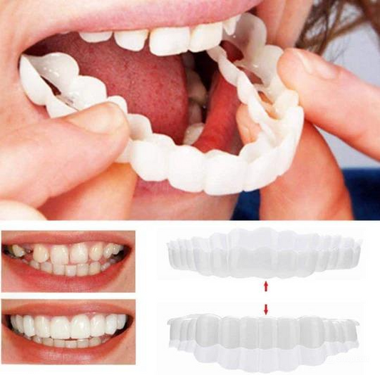 Smile Veneer – Snel, Makkelijk en Goedkoop Tandenbedekking voor Een Perfecte Glimlach